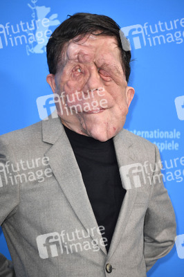 Photocall 'A Different Man', Berlinale 2024