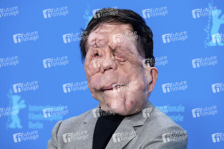 Photocall 'A Different Man', Berlinale 2024